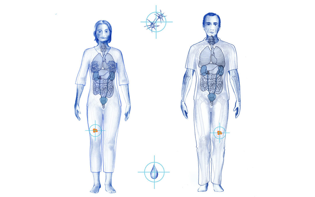 Which is your type of cancer?