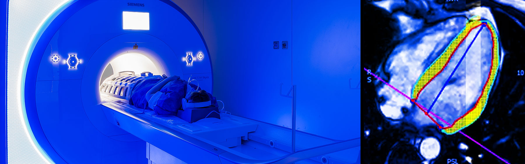 Cardiac magnetic resonance imaging