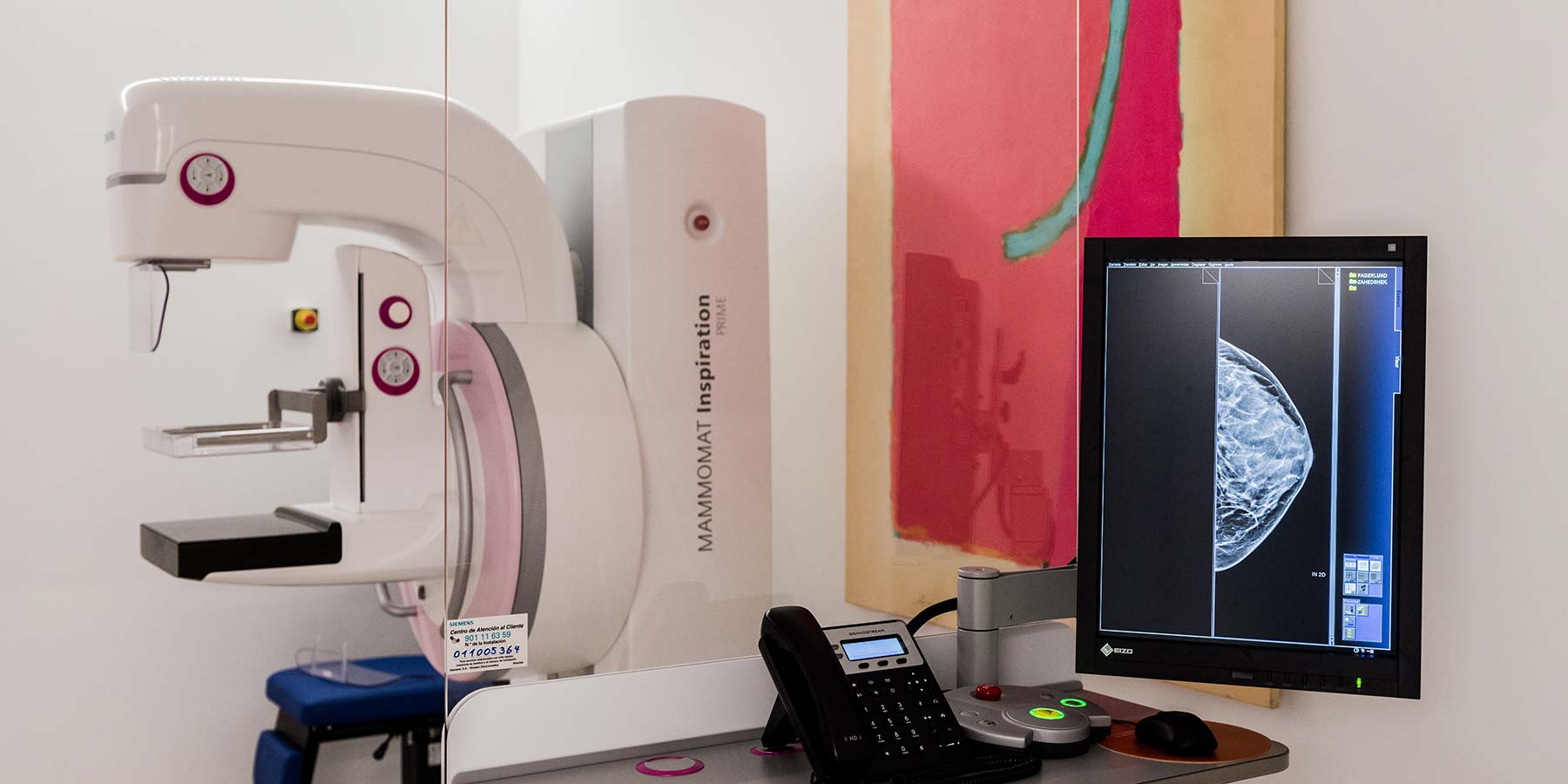 Tomosíntesis Mamografía 3D