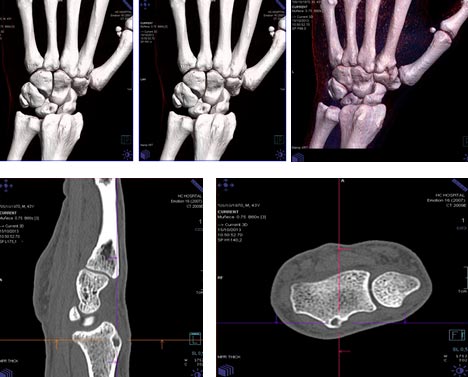 Trauma CT