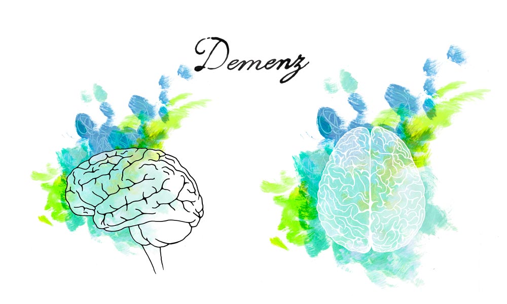 demenz