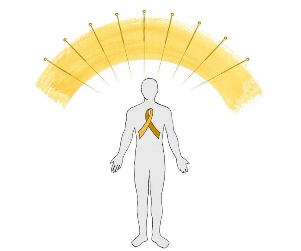 Cancer Acupuncture