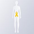 Endometriosis