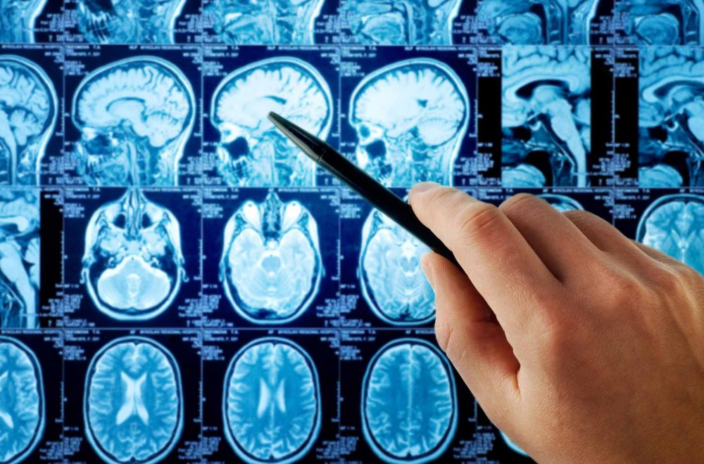Neurología Marbella
