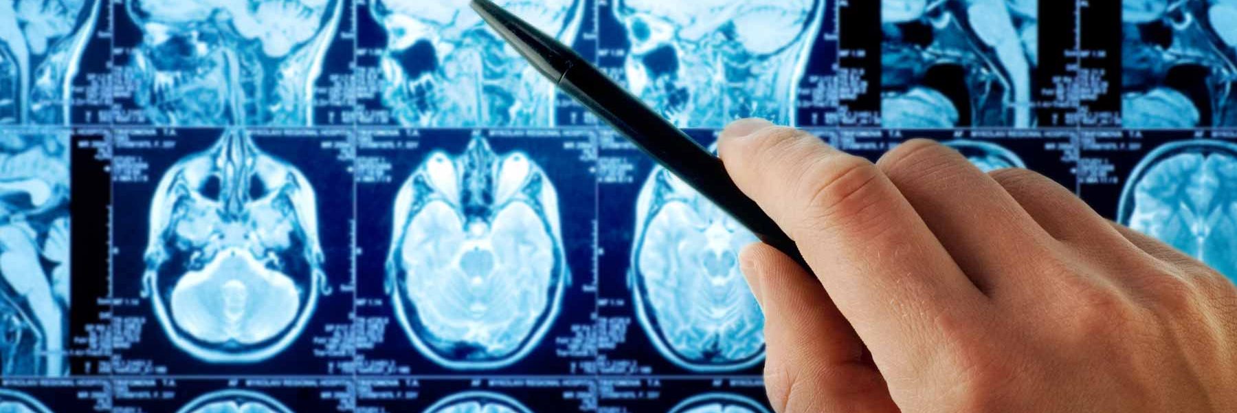 Neurología Marbella