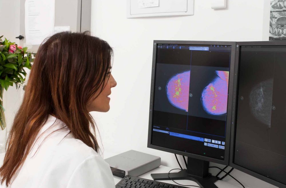 Oncología Unidad Mama
