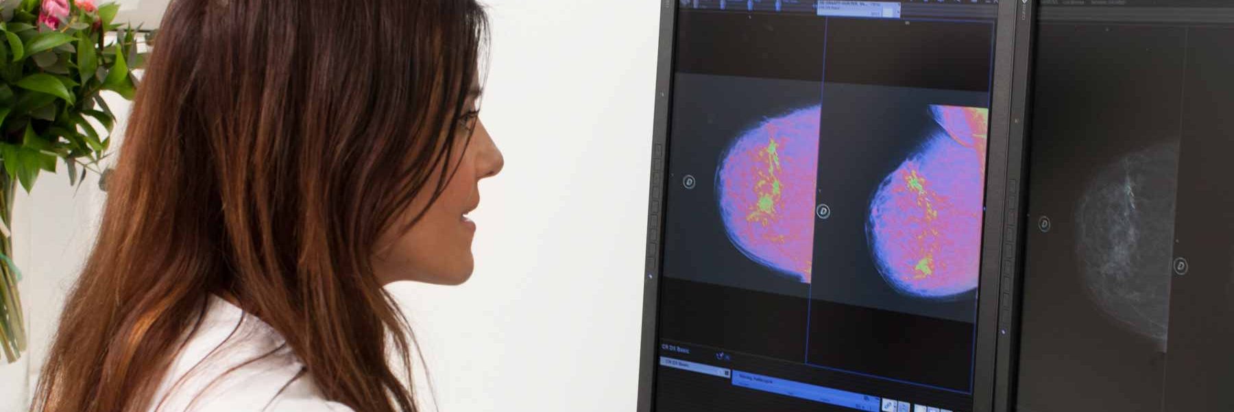 Oncología Unidad Mama
