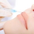 estética en marbella