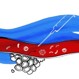 biopsia_liquida_hematologia