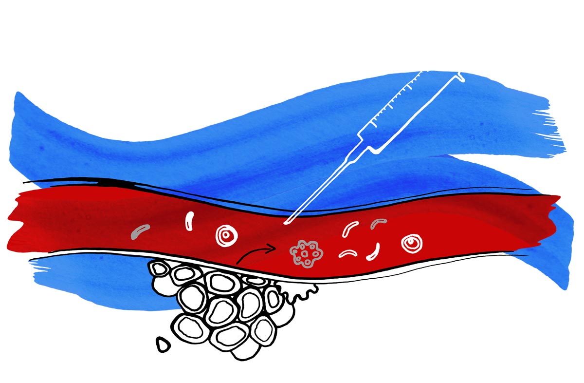 biopsaia liquida