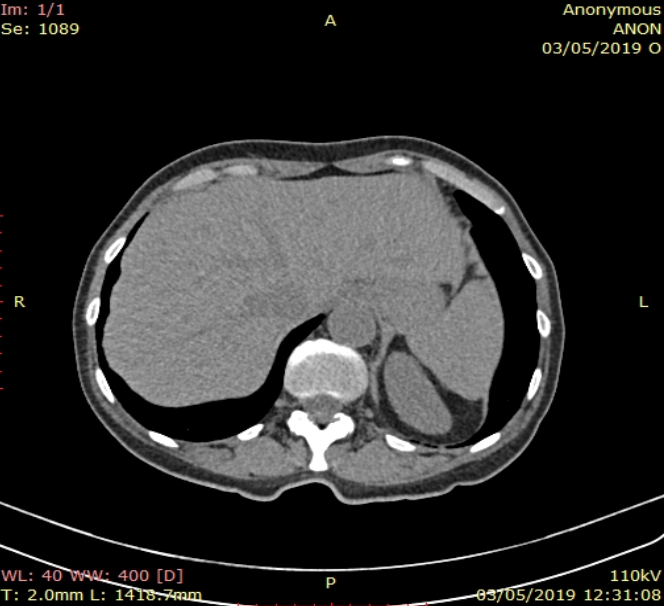 Imagen corte axial del abdomen
