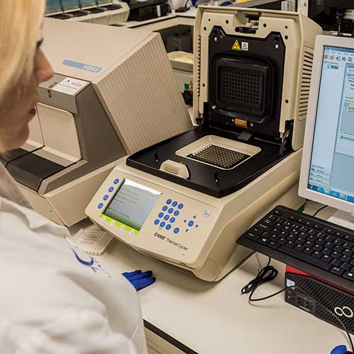 PCR