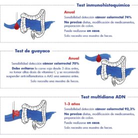 test sangre oculta en heces