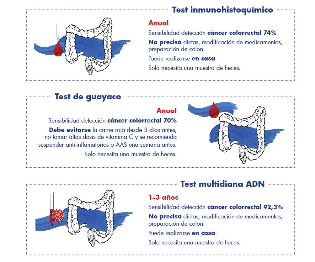 test sangre oculta en heces