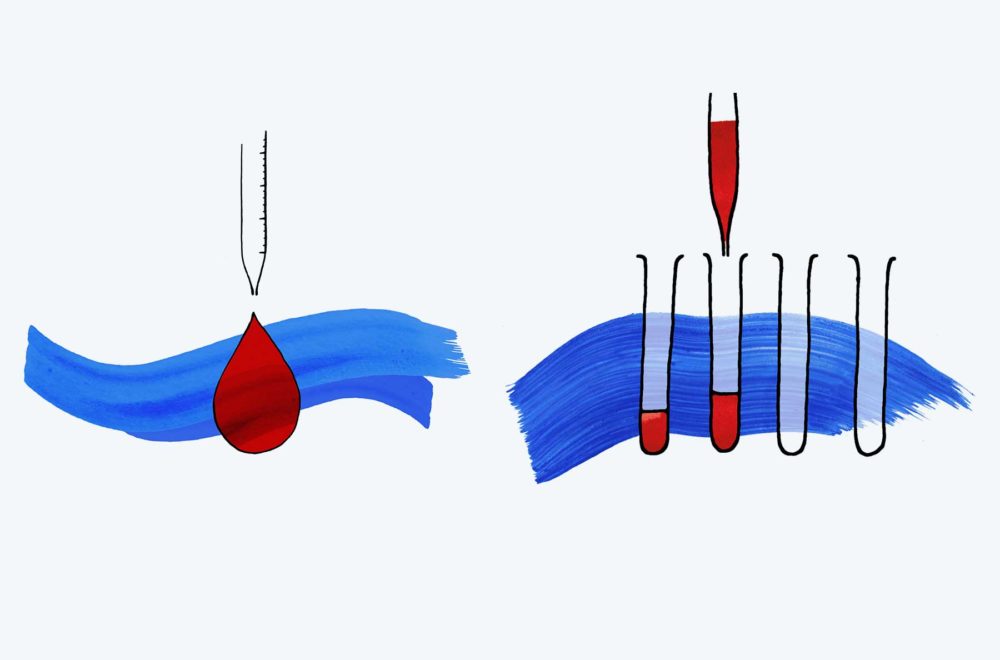 hemoterapia