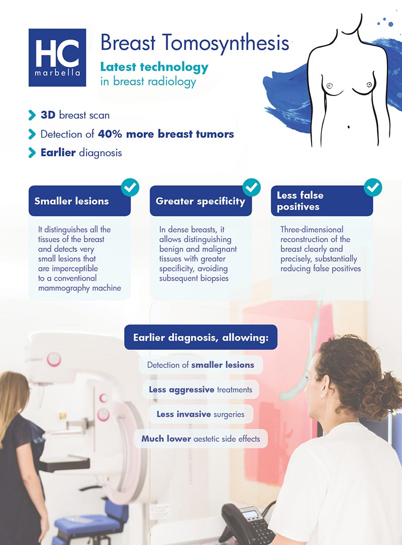 Breast Tomosynthesis