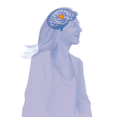 PET TC tumores cerebrales