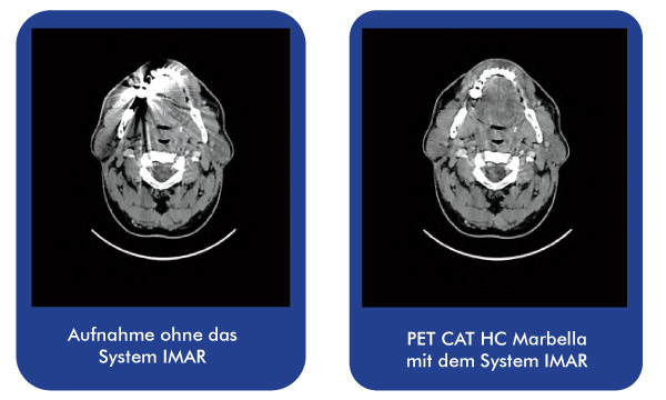 PET-CAT-HC-Marbella-mit-dem-System-IMAR