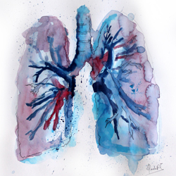tipos de cancer de pulmon