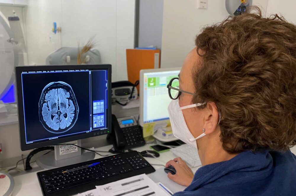 neurología Marbella