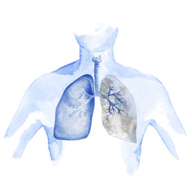 Enfisema pulmonar y EPOC: un tratamie...