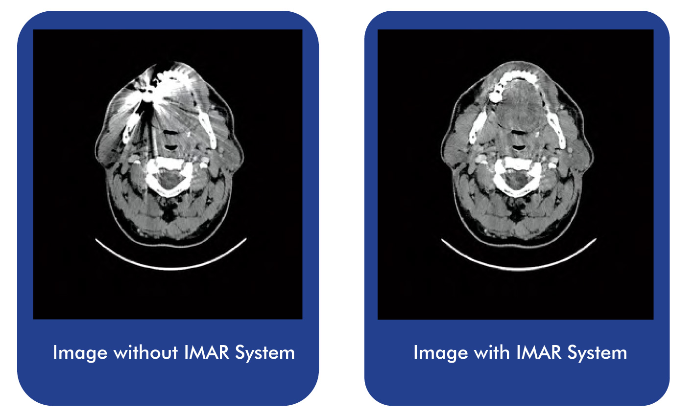 IMAR system