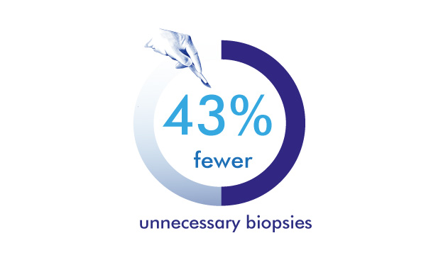 fewer biopsy