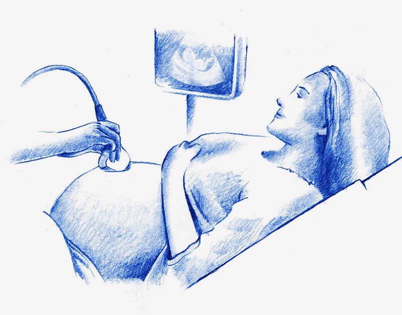 ecografía obstetricia