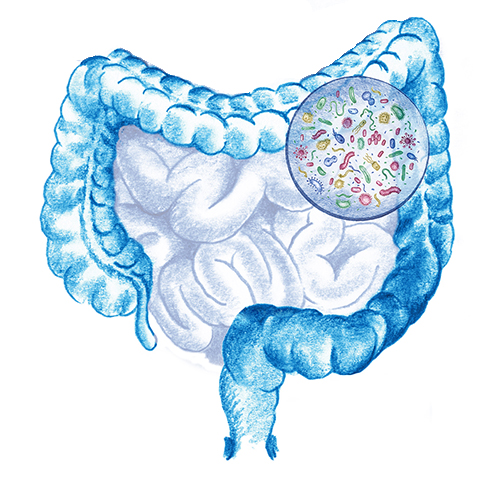 enfermedades-intestinales