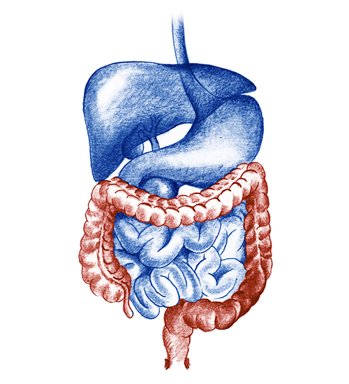 Enfermedades del intestino