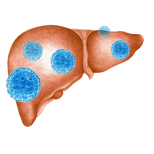 hepatitis-C_virus