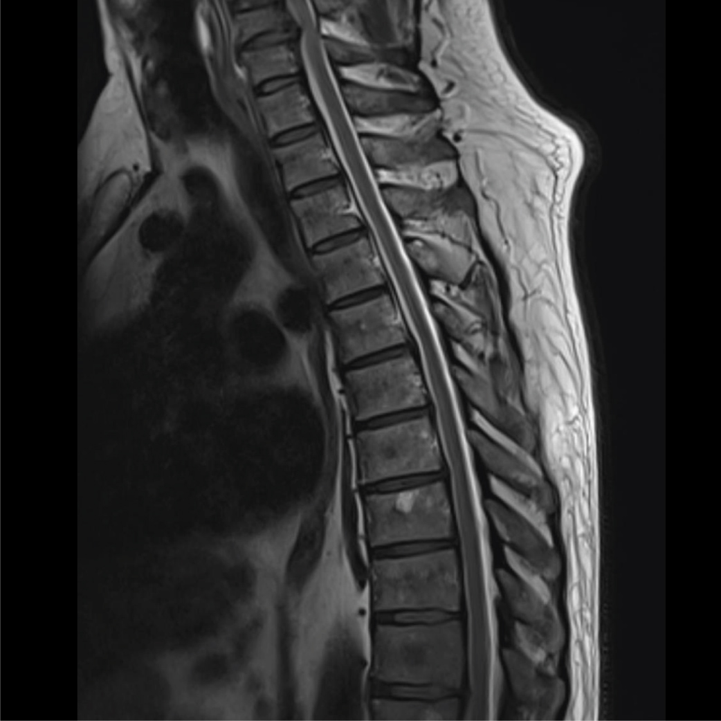 pet tac neurología