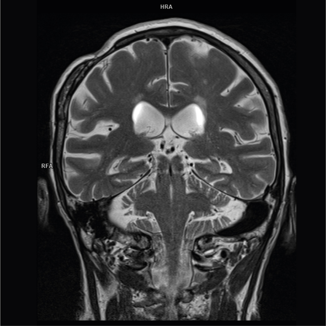 rmn neurologica