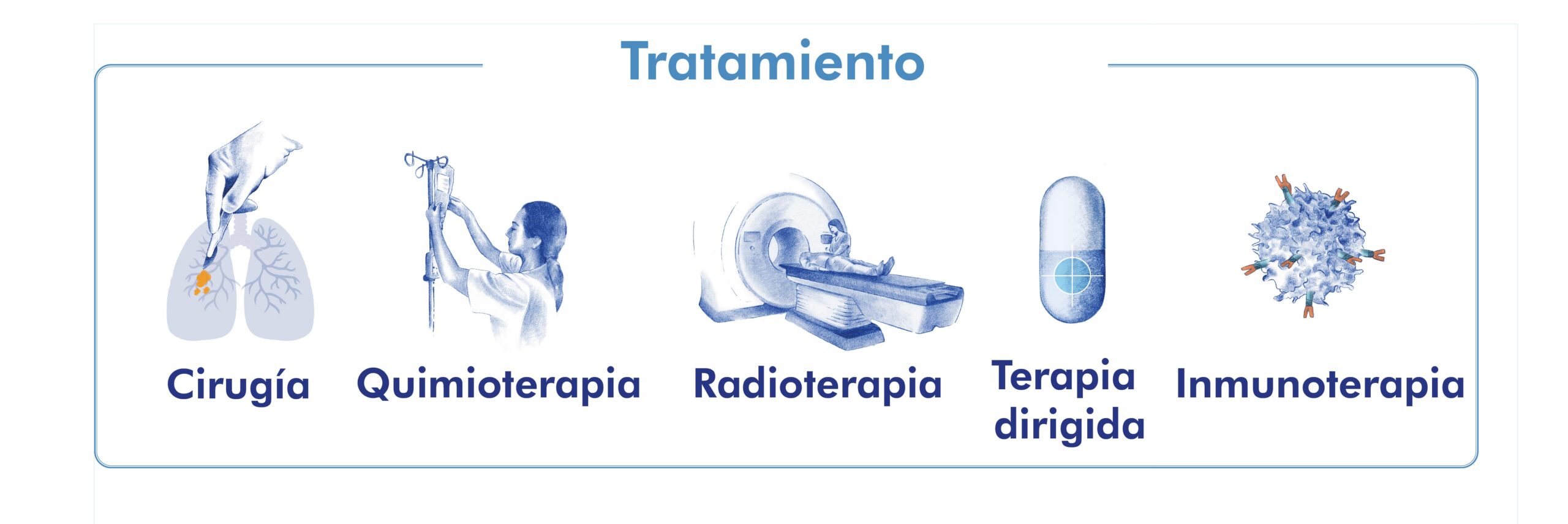 Tratamiento cáncer de pulmón