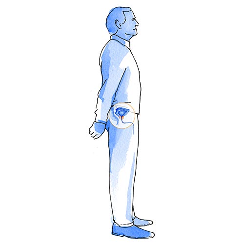 consulta con tu urólogo