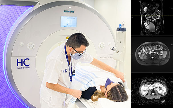 Resonancia Magnética abdominal