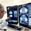 diagnostico de mama con inteligencia artificial
