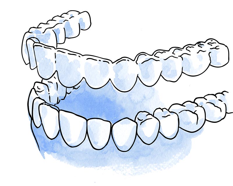 retenedor dental