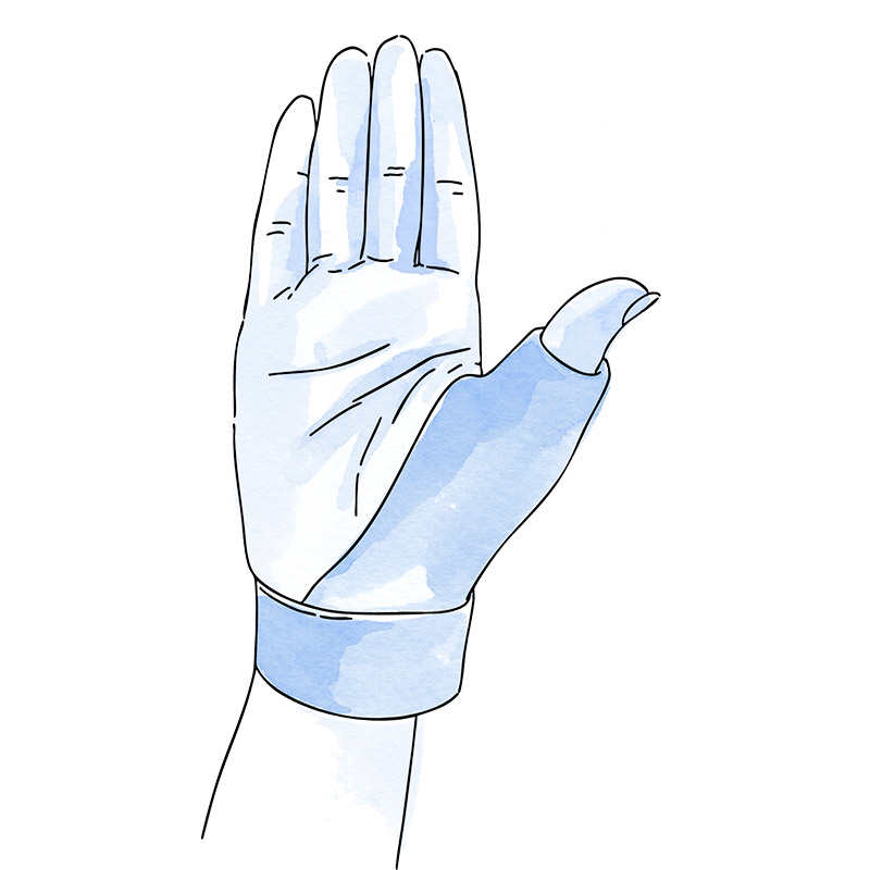 rizartrosis tratamiento