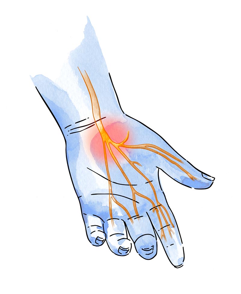 patología mano