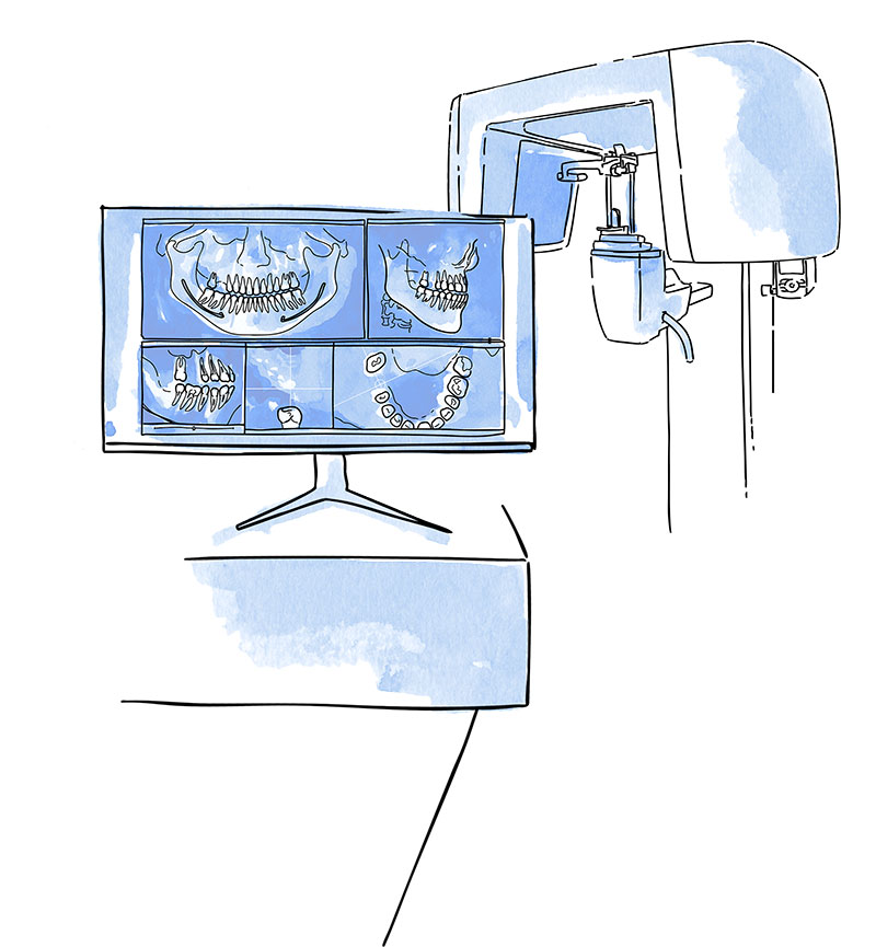CBCT dental Marbella