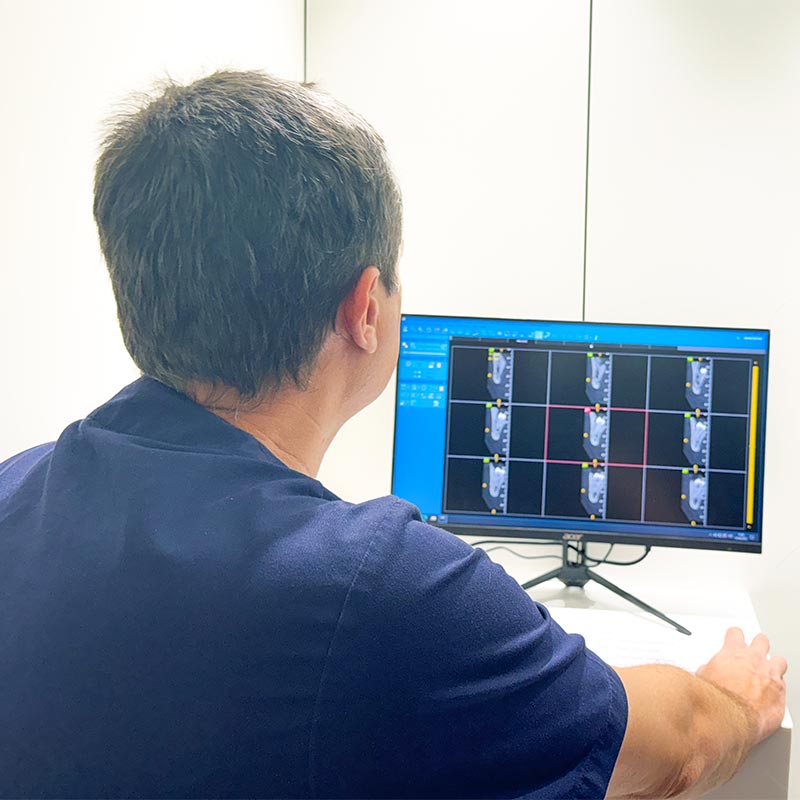 CBCT Dental