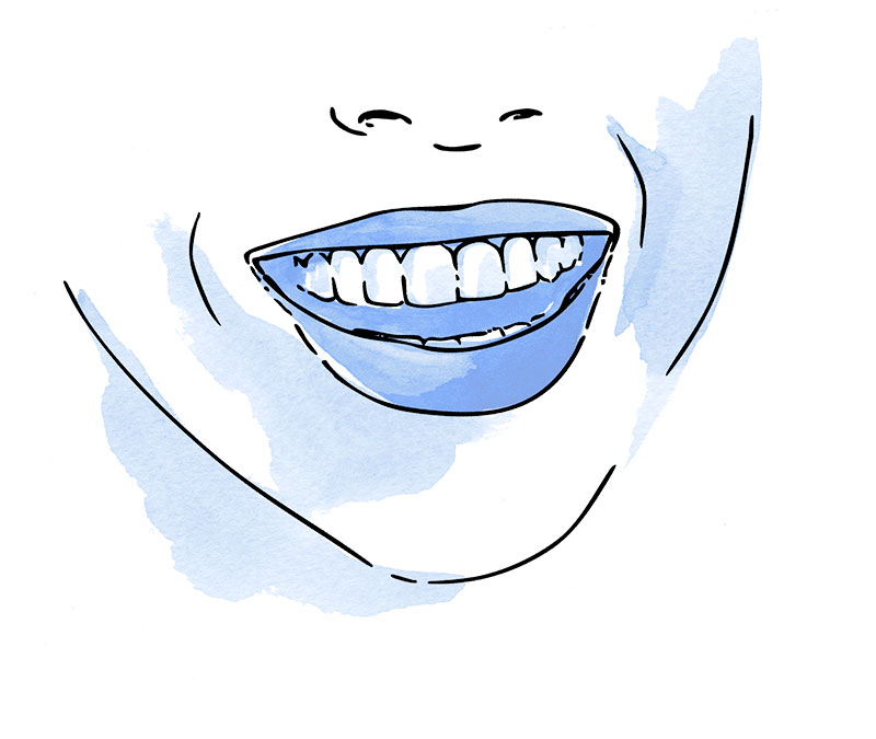 sonrisa