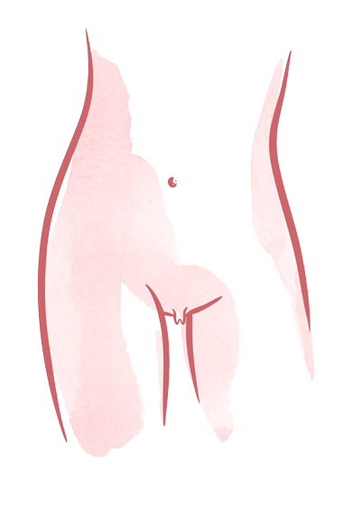 labioplastia-marbella