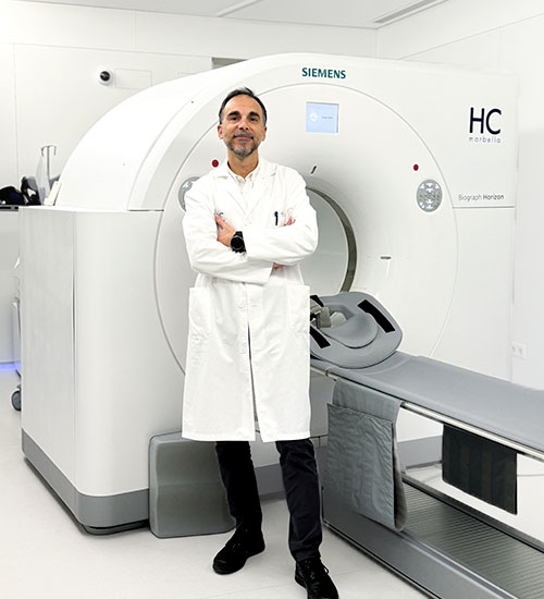 BEneficios del PET TC en Neurología