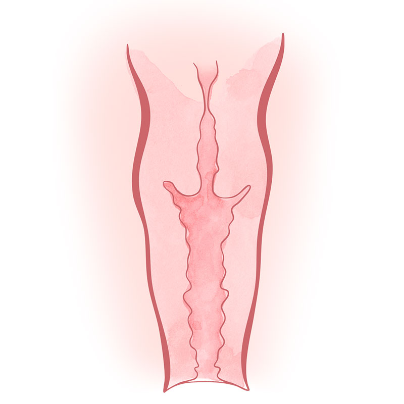 reconstrucción vaginal Marbella