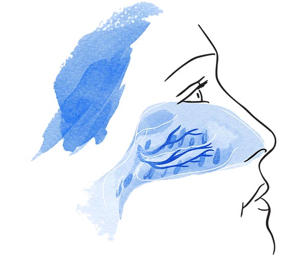 crioterapia cornetes