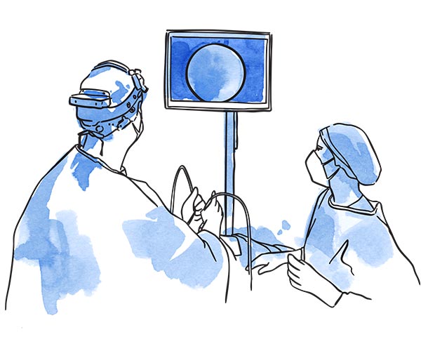 crioterapia nervio nasal