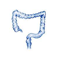 Colon and rectal cancer