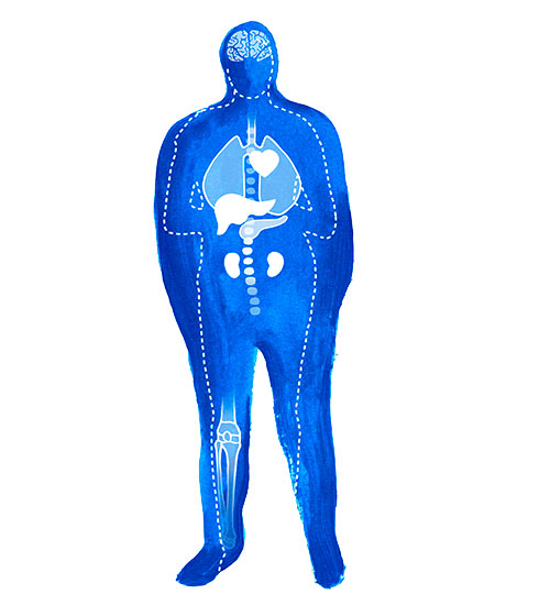 Preguntas frecuentes obesidad